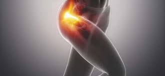 Fais le à genou en gardant le bas du dos droit. Le Traitement De L Articulation Sacro Iliaque Clinique Physio St Hubert