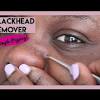 To use the extractor for nose blackheads, you will need to adjust the angle. Https Encrypted Tbn0 Gstatic Com Images Q Tbn And9gcrew5prpisso0qatit5ygpmi7tpkhzgmbccgkfpb6wxyh1op1jc Usqp Cau