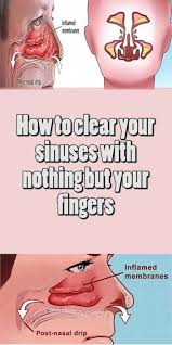 How To Clear Your Sinuses In Seconds Using Nothing But Your Fingers Step To Health Life Sinusitis How To Clear Sinuses Sinus Cavities