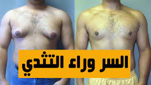 التثدي عند الرجال انواعه واسبابه وطرق علاجه/كيف اتخلص من التثدي/علاج ترهل  الثدي عند الرجال - YouTube