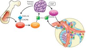 In the diagnosis of bone marrow cancer, radiographic methods, bone scintigraphy, computed tomography (ct), and magnetic resonance imaging (mri) are required. Bone Marrow Derived Mscs Promote Prostate Cancer Growth And Download Scientific Diagram