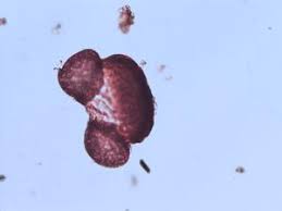 Image result for Afrobrunnichia erecta