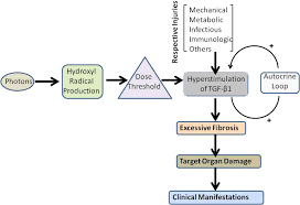 Image result for Radiation Colitis