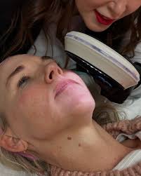 Bespoke Medical Aesthetics & Wellness (@bespokemedaesthetics) • Instagram  photos and videos