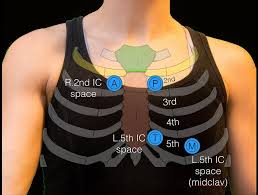 Rib 2 is thinner and longer than rib 1, and has two articular facets on the head as normal. Sternal Angle Youtube