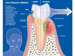 Notre Bouche Abrite Plusieurs Milliards De Bacteries Formant Le Microbiote Le Plus Abondant Du Hygiene Bucco Dentaire Microbiote Intestinal Hygiene Corporelle