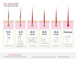If You Compare Different Hair Removal Methods Laser Hair Removal Is One Of The Most Effective Hair Removal Methods Laser Hair Hair Removal