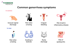 Image result for gonorrhea symptoms