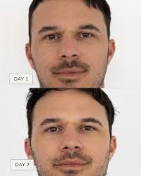 I have no idea why I haven't started looking after my skin like this  before! Thank you Sonya, my skin feels and looks amazing!”