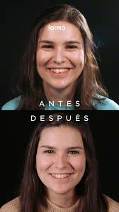 Si crees que el caso de Carmen se parece mucho al tuyo, solo tienes que  decírnoslo ☺️ Nuestro equipo, capitaneado por el Dr. Sergio de la Torre, se  encargará de ayudarte para