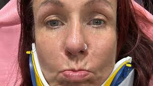 Fundraiser by Ryan Casper Harrison : Donate to Maggie's Recovery and New  Car Fund