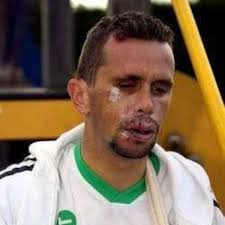 Fransman Jimmy Casper hervat zondag