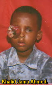 Be part of this noble mission to rescue the sight of Khalid Jama Ahmed