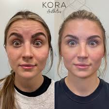 Botox Injections Near Me in Scottsdale, AZ