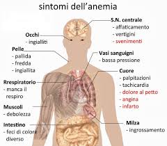 L'anemia mediterranea o talassemia è una malattia del sangue ereditaria più o meno grave. Anemia Mediterranea Come Migliorare Con La Dieta Dieta Gruppo Sanguigno