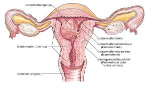 Wenn sich in der muskulatur der gebärmutter gutartige knoten bilden spricht man von einem uterusmyom. Endometriumpolypen Gebarmutterpolypen Eesom Gesundheitsportal