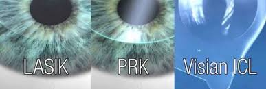 Currently, chicago eye care and laser specializes in internal medicine and ophthalmology with 1 physician. Sharpevision Modern Lasik Reviews Laser Eye Surgery Lasik At 145 W North Ave Chicago Il