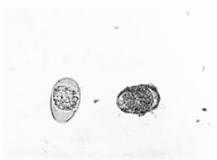 Image result for what is a good treatment for coccidiosis in cattle