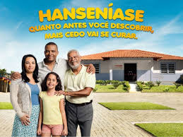 Resultado de imagem para dia mundial de combate à hanseníase