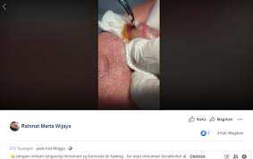 We did not find results for: Parasit Yang Dikeluarkan Dari Dalam Bibir Pria Ini Berasal Dari Kaleng Minu