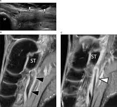 The muscles acting on the foot can be divided into two distinct groups; Sonographic Evaluation Of Plantar Hindfoot And Midfoot Pain Hoffman 2013 Journal Of Ultrasound In Medicine Wiley Online Library