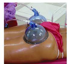 Ultrasonic cavitation works better diet and exercise. Ultrasound Fat Cavitation Training Oleanders Products Training Center