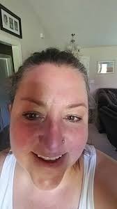 Is being butthurt considered hip discomfort?