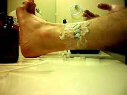 Chemical peels made with tca (the ingredient found in many tattoo removal creams) can be performed in a doctor's office. Tattoo Removal With Tca Episode 1 Youtube