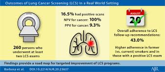 How do i know if i have breast cancer? Improving Lung Cancer Ct Screening Performance In Real World Settings Imaging Technology News