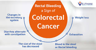 Image result for Blood in stool