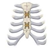 Titanium Sternal Fixation System | Products | DePuy Synthes