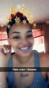 Black And Baby Blue Braces Braces New Color Lilac New Color Purple
