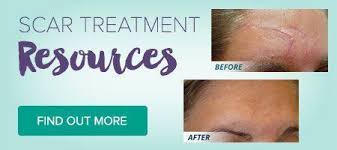 Face Bio Oil For Scars Before And After Pin On Combination Face Moisturizer