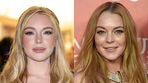 Did Lindsay Lohan Get Plastic Surgery?