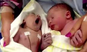 Parents of UK's youngest organ donor hope others will be inspired