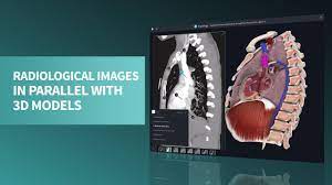 View radiological images in parallel with 3D models - YouTube