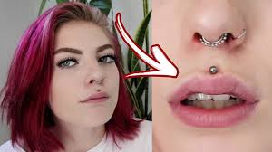 This helps prepare the area for new tissue growth. Super Swolen Lip Healing Process Medusa Philtrum Piercing Youtube