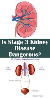 Renal Failure Treats En 2020
