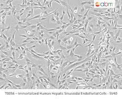 Immortalized Human Hepatic Sinusoidal Endothelial Cells-SV40 - Homo  sapiens/Human Liver/Liver for Research | ABM | Applied Biological Materials  Inc.