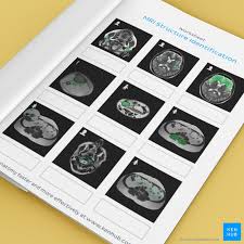 In this quiz, you will get to test out just how good of a radiologist you would make or do make. Mri Study Guide Quizzes Test Questions Flashcards Kenhub