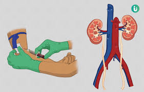 Kidney Renal Function Test Procedure Purpose Results Cost Price