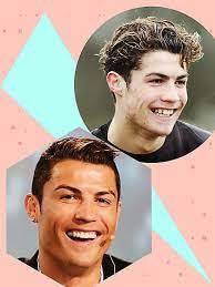 Futball star cristiano ronaldo knows that from experience. Promis Mit Neuen Zahnen Unser Grosser Vorher Nachher Vergleich Stylight