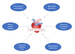 Image result for Cardiomyopathy