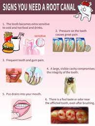 Dentaltown Where The Dental Community Lives Wurzelkanalbehandlung Zahnmedizin Zahnbehandlung