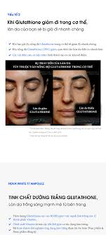 NOVA WHITE 17 AMPOULE 30ML.