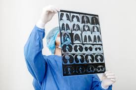 Image result for Simplified PESI