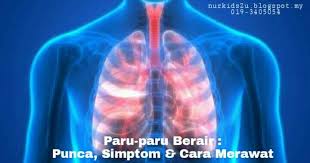 Masalah jantung (cardiogenic pulmonary edema). Never Lose Hope Paru Paru Berair Macam Tak Percaya Boleh Sihat Semula Ini Rupanya Cara Lelaki Ini Berubat