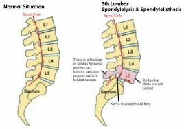 All of the modules must be written in coffeescript. Top 10 Reasons For Back Pain Penang Chiropractor