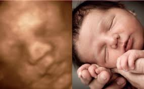 In primele 20 de saptamani de sarcina, prin ecografie se pot depista multe malformatii fetale ce diferente sunt intre diferitele tipuri de ecografie in sarcina? Ai Grija De Tine Si De Bebe Inca Din Burtica Ecografie Arhivat Pg3