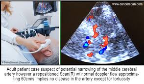 Diagnostics | Free Full-Text | The Role Of Multimodality Imaging Approach  In Acute Aortic Syndromes: Diagnosis, Complications, And Clinical Management